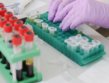 Απεργία διαγνωστικών κέντρων: Σήμερα η συνάντηση των εκπροσώπων του κλάδου με τον Ανδρέα Ξανθό